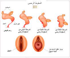 مكنك تقوية عضلات الحوض من خلال تمارين كيجل انتظرونا فىي معلومة فى كبسولة العلاج health advice health the cure