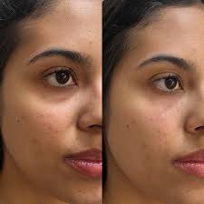 Daniela Baroni Ganiko