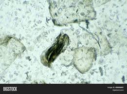 Yeah, should definitely try getting new skin. Skin Under Microscope Image Photo Free Trial Bigstock