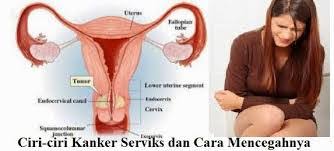 Pasalnya, ini hanya terjadi pada mereka yang mengidap kanker serviks stadium. Ini Gejala Umum Kanker Serviks Yang Tak Boleh Diabaikan Berita Pedoman