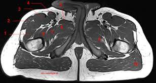 The hip bone has three parts: Mri Of The Thigh Detailed Anatomy Superior Part W Radiology
