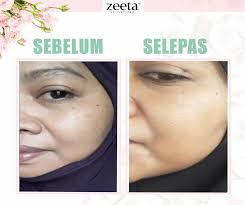 All suggested by the sales girl. Rose Face Serum Zeeta Rahsia Bagaimana Menghilangkan Jeragat Dan Parut Jerawat Sepantas 14 Hari Blog Sabree Hussin