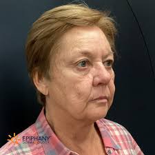 Epiphany Dermatology Charleston