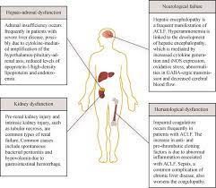 Common Multiple Organ Dysfunctions In Acute On Chronic Liver Failure Download Scientific Diagram