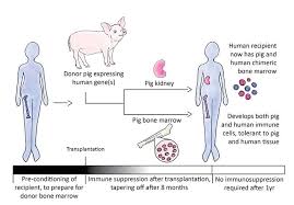 Commentary Current Status And Future Of Corneal Xenotransplantation Human Tissue Pig Kidney Current