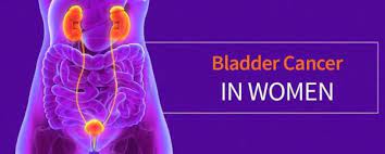 Also here considered the causes of this disease and how to diagnose and get rid of the problem. What To Know About Bladder Cancer In Women Cxbladder