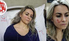 İlçe hastane.com.tr sitesindeki içerikler geneldir, kişisel teşhis ya da tedavi yönteminin seçimi için doğrudan kullanılmamalıdır. Personel Saglik Haber Arsivleri Sayfa 40 45 Guncel Saglik Haberleri