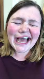 One time I went to the dentist and they ended up numbing the entire right  side of my face