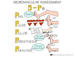 The 5 Ps Of Neurovascular Assessment Nursing Assessment