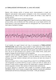 Esecuzione di un ecg in emergenza. La Fibrillazione Ventricolare