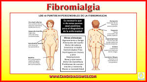 Traducir fibromialgia significado fibromialgia traducción de fibromialgia sinónimos de fibromialgia, antónimos de fibromialgia. Fibromialgia O Fatiga Cronica Y Su Relacion Con La Candidiasis
