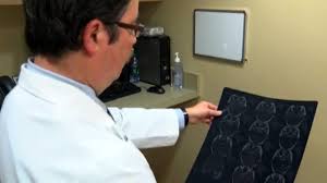 Our valheim cheats and console commands guide will show you how to use the console and unlock cheat codes, along with an explanation of every console command available. Simple Take Home Test May Spot Early Alzheimer S Warning Signs Cbs News
