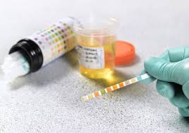 How long does it take to get alcohol out of your blood? Etg Test For Confirming Alcohol Abstinence