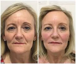 Sheryl Grace Herrera Aesthetic & Training Center