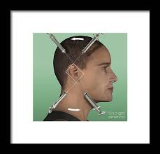 Image result for Ear Nerve Block