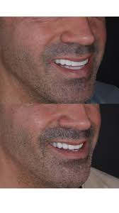 Yo no estaba seguro… hasta que conocí al Dr. Daniel.” Fabrizio dudaba. El  miedo al cambio, la incertidumbre de no saber cómo iba a quedar… todo eso  lo detenía. Pero bastó una