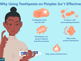 Toothpaste On Pimples: Does It Work?