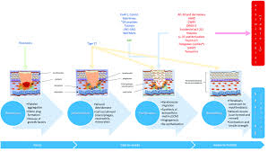 phases of wound healing chart thelifeisdream