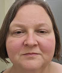 Hi Everyone. Let me list my symptoms so you can accurately diagnose me. For  almost 5 years now I've been extremely fatigued. The lack of energy is  constant. There is also lack