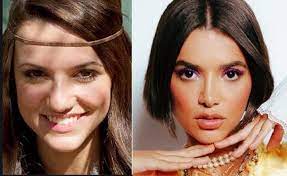 Manu gavassi antes e depois: Manu Gavassi Ja Fez Plastica No Nariz E Botox Veja Mudancas Patricia Kogut O Globo