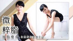 美麗人妻的微粹脂抽脂瘦身自體脂肪隆乳豐胸日記影片分享台北亞緻- YouTube