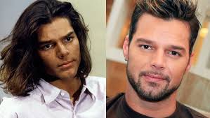La bichectomía en hombre es tendencia ya que, al igual que en las mujeres, permite bichectomía en hombre, cuándo se recomienda. Hombres Famosos Antes Y Despues De Una Cirugia Estetica