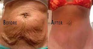Pin On Health And Beauty