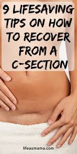 Having Major Surgery Like A Cesarean Is Not To Be Taken Lightly And You Really Need To Make Sure You Take Good Care C Section Baby Care Tips New Baby Products