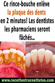 Ce Rince Bouche Enleve La Plaque Des Dents En 2 Minutes Les Dentistes Les Pharmaciens Seront Faches Remedesnatur Dental Health Care Gum Care Oral Health Care