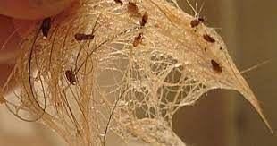 Fleas need to be sprayed with a strong chemical in order to control their if you have a bed, theres bedbugs. How To Know If You Have Fleas In Your House Hunker Fleas Spider Bites Flea Bites