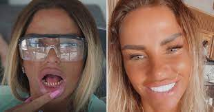 Now you've probably seen the haunting images of katie's teeth before having new veneers fitted in. Katie Price Rushing Back To Turkey To Fix Teeth After Two Fell Out Metro News