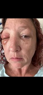 Fundraiser for Heather Maurin by Reanna Maurin : Heather's Medical  Emergency Relief Fund