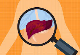 Total body irradiation (tbi) radiation to the whole abdomen; 4 Signs Your Liver Is In Trouble Tips To Protect It Health Essentials From Cleveland Clinic