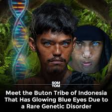 The Buton tribe of Indonesia carries a rare trait, glowing blue eyes caused  by Waardenburg syndrome. It's not contact lenses or outside influence, but  a genetic condition that affects pigmentation. Photographer Korchnoi