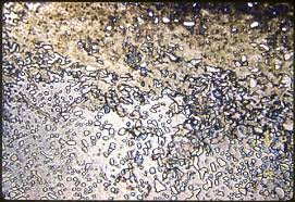 نتیجه جستجوی لغت [abrasively] در گوگل