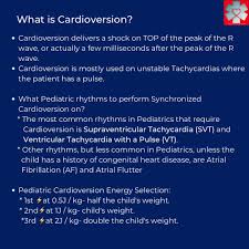 Image result for Synchronized Cardioversion