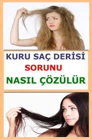 Kuru Sac Derisi Bakimi Bakimi Derisi Kuru Sac Sacbakimi Sacbakimidokulen Sacbakimikuru Sacbakimiyipranmis Sac Sac Bakimi Sac Dokulmesi