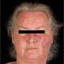 A Warfield's research works