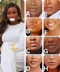 16 16+2x4 4 +2x 72-1124 72 24 โนม