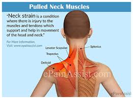 Pull your shoulder blades down and back. Cervical Sprain Strain Blog Maywood Physical Therapy