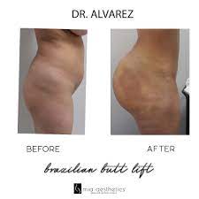 Alvarez, founder of mia aesthetics specializes in plastic surgery that fits each patient's goals. Mia Aesthetics On Twitter Dr Alvarez Did What He Had To Do Https T Co 4wh6y1lj4s Twitter