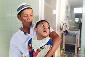 Ayunan anak bayi ditengah pintu. Jatuh Dari Ayunan Bocah Sumut Menderita Lumpuh Otak Antara News