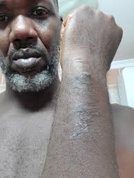 Fundraiser by Marcus Dodd : COVID-19 and Racism