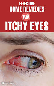 13 Home Remedies For Itchy Eyes Causes And Prevention Tips Itchy Eyes Allergy Eyes Itchy Eyes Remedy