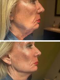 Lindsay Tarlow Rubenstein