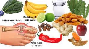 Gout Foods To Avoid Gout Diet Purines Chart Uric Acid