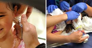 We use only piercing earrings with sharp posts. Young Girl Hospitalized After Claire S Accessories Ear Piercing Goes Wrong