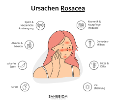 Rosacea Ursachen Symptome Behandlung Sanubiom