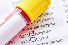 Quality control of protein localization. A New Certified Reference Material For Quality Control Of Alpha Amylase Clinical Measurements Eu Science Hub