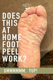 How All The Skin Peeled Off Of My Feet Home Pedicure Review Pedicure At Home Peeling Skin Foot Skin Remover